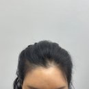 연수동눈썹 연수동헤어라인 자연스럽고 꼼꼼했던 아미다인 후기 1탄