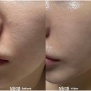 문스킨케어 이미지