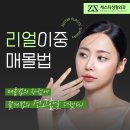 제스타성형외과의원 | 쌍수이중매몰법 적합한지 알아보며, 리얼후기 확인!