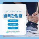 성모척척마취통증의학과의원 | 상계동마취통증의학과, 발목 앞쪽 뻐근함과 움직일 때 나는 마찰음? '발목관절염'