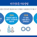 안구건조증 증상 및 원인 : 치료방법 영양제 안약 눈건조할때 이미지