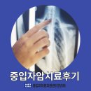 젊은신경과 | 암세포를 정확하게 조준하고 완전히 파괴하는 중입자암치료후기