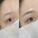 아인뷰티랩 분당눈썹 이미지