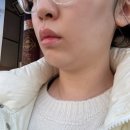 예쁜얼굴 | 오목교 피부관리실 가인미가, 얼굴축소경락 예쁜 얼굴 라인 찾은 후기