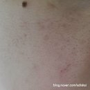 [ 엠에스글로벌바이오 ] 시카후코이단크림 사용후기 : 미백효과 보습력 주름개선