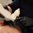 웅신프라자 | 일산두피관리 일산탈모관리 웰킨 두피탈모센터 정발산역점 두피점검 두피스케일링 산소케어 후기