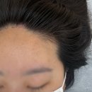 빈코리아 | [ 강남헤어라인 ] 피시엘 코리아 1차 헤어라인 손본 솔직 후기