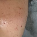 유스앤영서울뷰의원 | 서울뷰의원 세종, 스킨보톡스