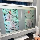 부산탈모관리 더노블메디센터 부산문제성두피관리 재방문 동래 30대 두피관리 추천 스트레스 탈모예방