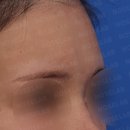 노즈랩의원 이미지