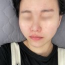 판암동145 | 판암동피부관리 대전동구피부관리“뷰마르 대전판암점” 얼굴 플라즈마 체험