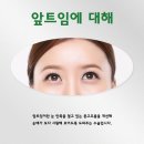 윤동주성형외과의원 네이버블로그