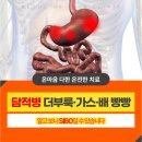 담적병증상 치료해도 반복된다면 SIBO를 확인하세요│서울온케어의원