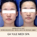 대구학정초등학교 | 대구 북구 피부관리 JH윤곽술 시술 &#39; 가율메디스파 &#39; 후기