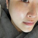 카인드솔루션 산청지점 | AI피부과 온다리프팅 3만줄 후기