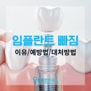 남중동-74 | 익산 남중동 영등동 모현동 임플란트 빠짐 원인/예방법/대처방법