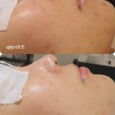 명품피부 이미지