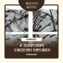 부경대소비자생활협동조합 - 남구 용당동 | 부산탈모관리 경성대부경대역 두피전문센터 모앤두피탈모 | 찐탈모인이 말아주는 관리 후기