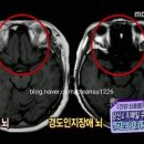 인지카 이미지