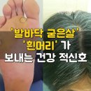 '발바닥 굳은살'과 '흰머리' 보내는 건강 적 신호 이미지