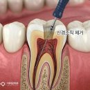 아이오치과의원 | 광주치과추천 음식 먹을 때 치통이 있어요