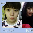윤곽