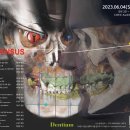 (주)덴티움 이미지