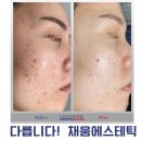 채움에스테틱 이미지