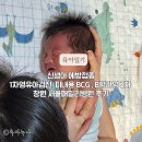 서울패밀리병원 | 신생아 예방접종 1차영유아검진, 피내용 BCG , B형간염 2차 창원 서울패밀리병원 후기