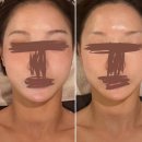 길평 | 고덕 에스테틱 추천 약손명가 평택고덕점 / 페이스 바디 전부 만족스러운 효과 맞춤관리A 솔직 체험 후기