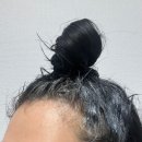 20대 여성 모발 얇아짐 탈모고민 알트로겐 탈모영양제 한달 복용 후기 솔직 효과와 변화