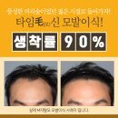 비절개모발이식후기, 다들 어려졌다고 놀라!! 이미지