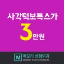 청주보톡스 삼만원의 행복 이미지