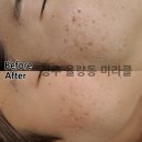 미라클피부관리실