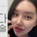 마침표성형외과의원 네이버블로그