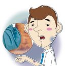 6/20(Wednesday)-Reasons for bruising 이미지