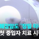 간암·췌장암도 '정밀 타격' 치료 시작…하루 문의만 200통 / JTBC 뉴스룸 이미지