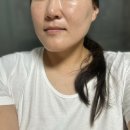 (주)센트럴메디칼 | 의정부 피부관리 연예인 리프팅 케어 받아보기 뷔에르 로얄5케어