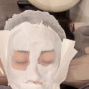 엑스날 | 청담동피부과 제네오엑스 후기 중요한날 피부관리, 물광효과와 리프팅까지 만족했던 내돈내산 후기