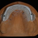 엘리트치과기공소 이미지