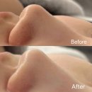 둔산중로78번길 | 둔산피부관리,블랙헤드제거 [끌올에스테틱 둔산점]