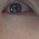 성신안과의원 이미지