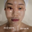 3171 | [철산역피부관리] 수뷰티센터광명점 더올리지오 리프팅으로 완성한 V윤곽관리 후기