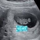 순천365여성의원 이미지