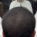 송 헤어샵 (song s hair ) | [끌리에헤어] 김해 두피페인팅 남자 정수리탈모 완벽 커버