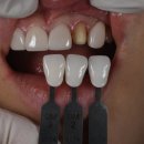 장치과기공소 이미지