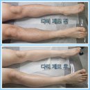 유니크뷰티살롱 | 미장동 왁싱샵 유니크 뷰티살롱에서 다리 제모하고 왔어요 #군산브라질리언왁싱 #군산남자브라질리언...