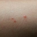 성가병원 | 💒 청주 성당 옴진드기 방역 후기 | 병원 판정 후 미소창방역 전문소독으로 완벽 해결!