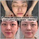 구파발 약손명가에서 양악 + 모공관리 받은 생생한 후기!