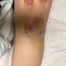 봄봄약국 | [#이대목동시험관1차]이대목동 25주차 임신성당뇨, 임당 검사(feat.재검당첨)